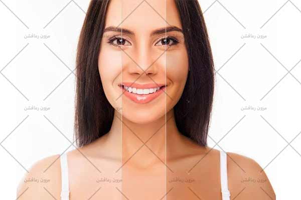 نحوه تشخیص رنگ پوست -مزون رمافشن